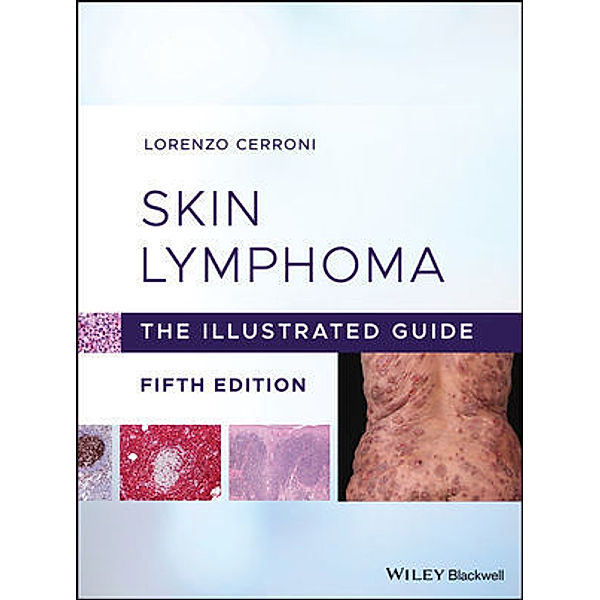 Skin Lymphoma, Lorenzo Cerroni
