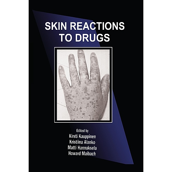 Skin Reactions to Drugs