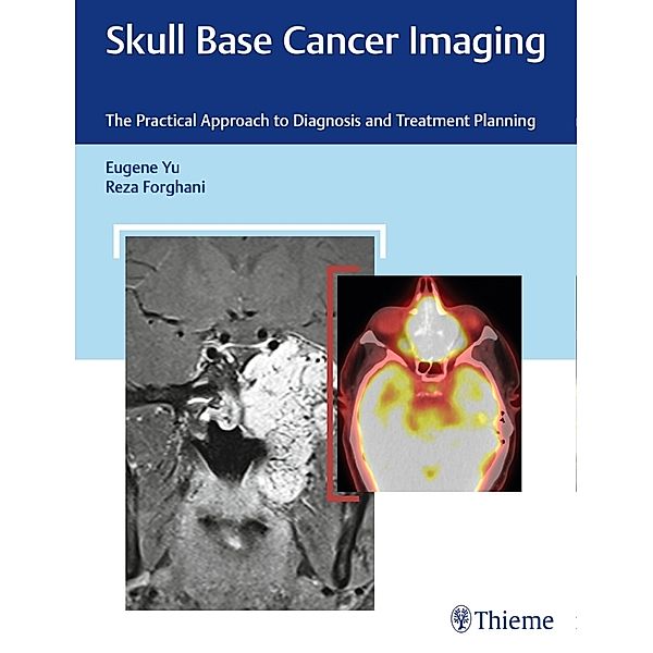 Skull Base Cancer Imaging, Eugene Yu, Reza Forghani
