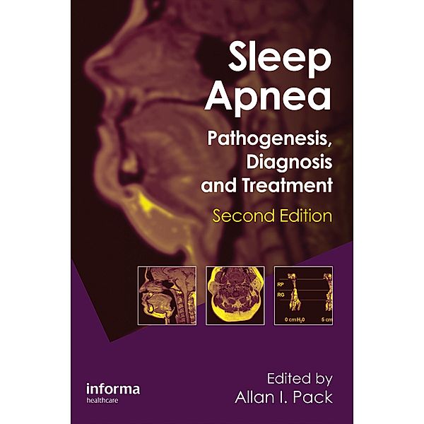 Sleep Apnea