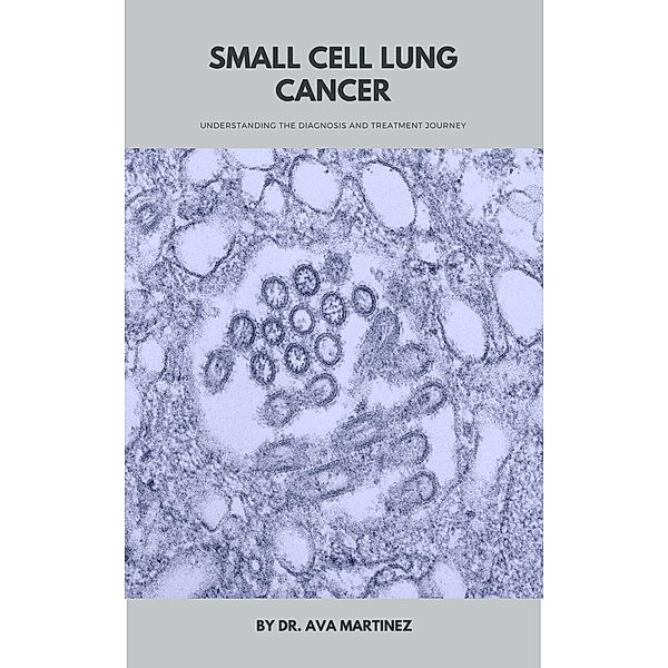 Small Cell Lung Cancer / Cancer, Ava Martinez