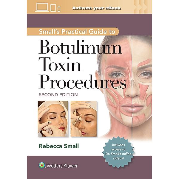 Small's Practical Guide to Botulinum Toxin Procedures: Print + eBook with Multimedia, Rebecca Small
