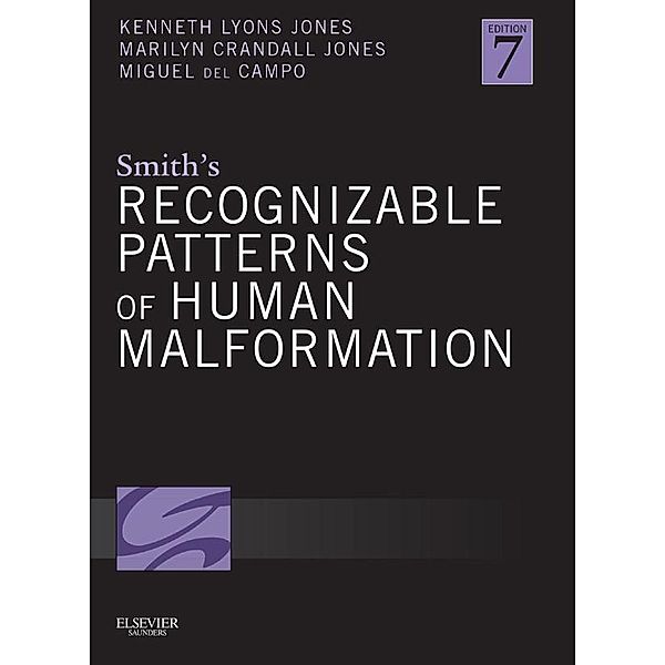 Smith's Recognizable Patterns of Human Malformation E-Book, Kenneth Lyons Jones, Marilyn Crandall Jones, Miguel del Campo