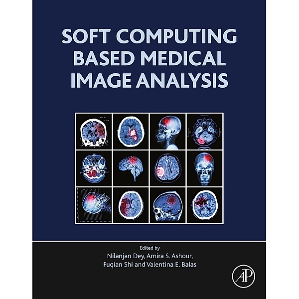 Soft Computing Based Medical Image Analysis, Nilanjan Dey, Amira S. Ashour, Fuquian Shi, Valentina Emilia Balas