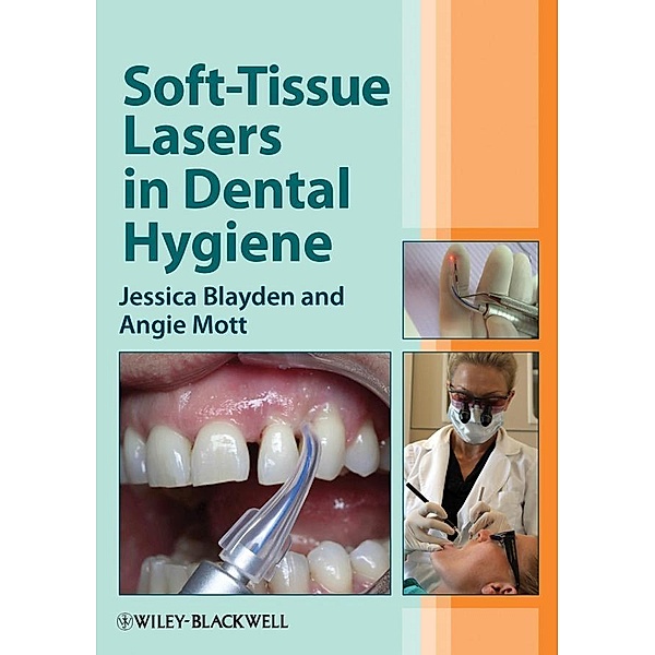 Soft-Tissue Lasers in Dental Hygiene, Jessica Blayden, Angie Mott