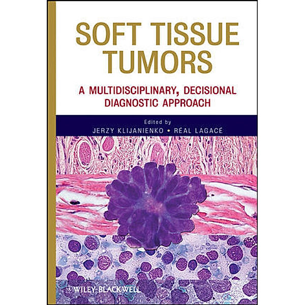 Soft Tissue Tumors: A Multidisciplinary, Decisional Diagnostic Approach, Jerzy Klijanienko, Real Lagace