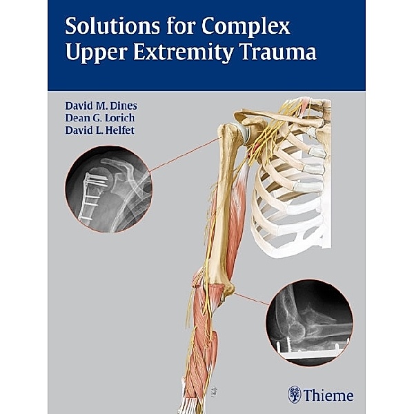 Solutions for Complex Upper Extremity Trauma, David M. Dines, Dean G. Lorich, David L. Helfet