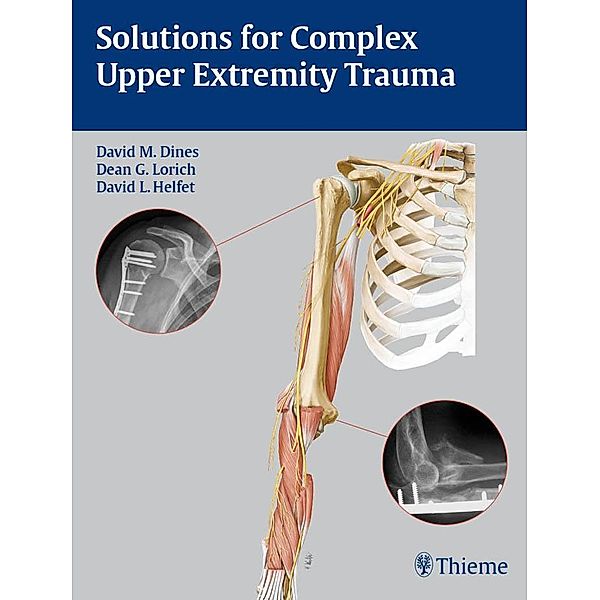 Solutions for Complex Upper Extremity Trauma