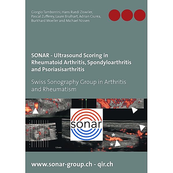 SONAR - Ultrasound Scoring in Rheumatoid Arthritis, Spondyloarthritis and Psoriasisarthritis, Giorgio Tamborrini, Hans Ruedi Ziswiler, Pascal Zufferey, Laure Brulhart, Adrian Ciurea, Burkhard Moeller, Michael Nissen