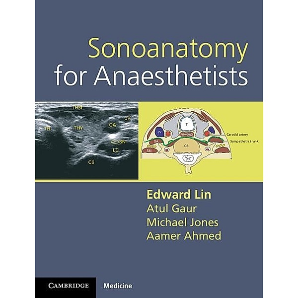 Sonoanatomy for Anaesthetists, Edward Lin