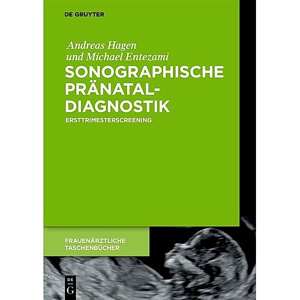 Sonographische Pränataldiagnostik / Frauenärztliche Taschenbücher, Andreas Hagen, Michael Entezami