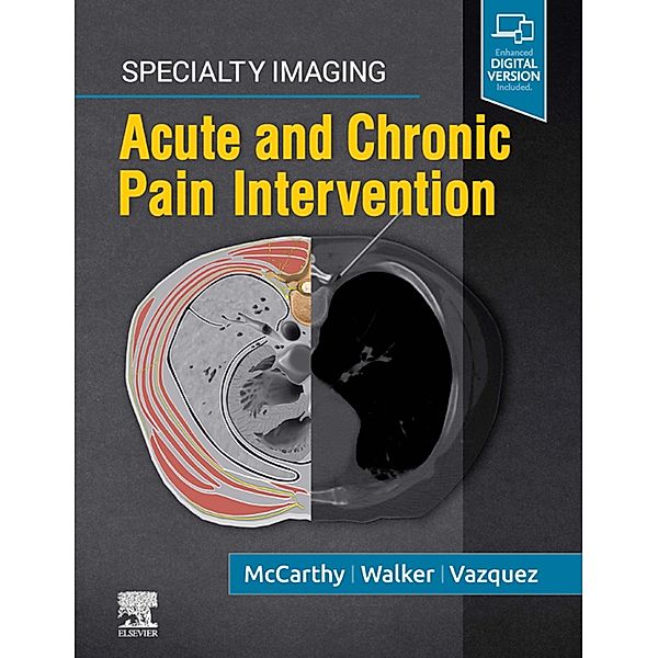 Specialty Imaging: Acute and Chronic Pain Intervention, Colin J. McCarthy, T. Gregory Walker, Rafael Vazquez