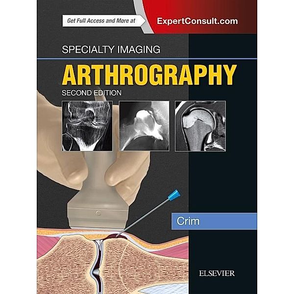 Specialty Imaging: Arthrography, Julia R. Crim