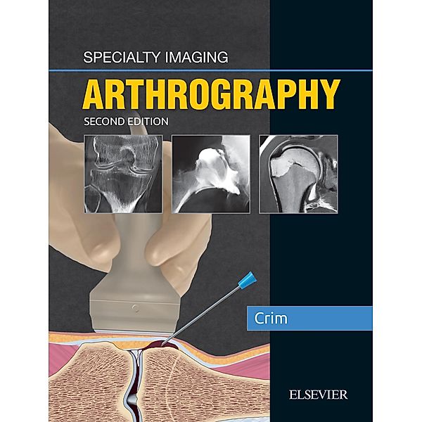 Specialty Imaging: Arthrography, Julia R. Crim