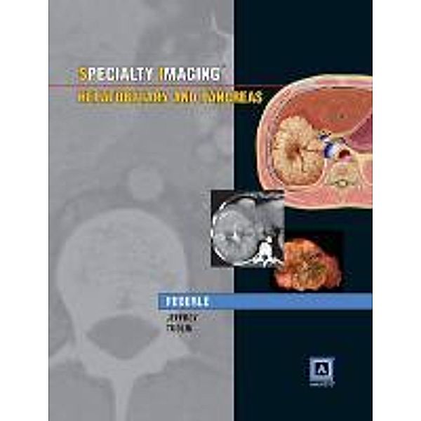Specialty Imaging: Hepatobiliary & Pancreas, Michael P. Federle, R. Brooke Jeffrey, Mitchell E. Tublin, Amir Borhani