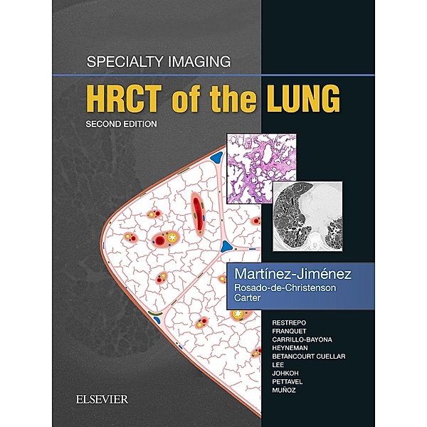 Specialty Imaging: HRCT of the Lung E-Book, Santiago Martínez-Jiménez, Melissa L. Rosado-de-Christenson, Brett W. Carter