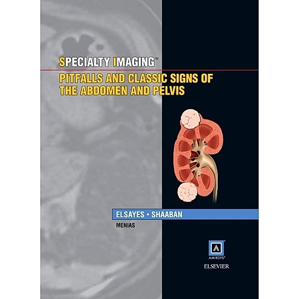 Specialty Imaging: Pitfalls and Classic Signs of the Abdomen and Pelvis, Khaled M. Elsayes, Akram M. Shaaban