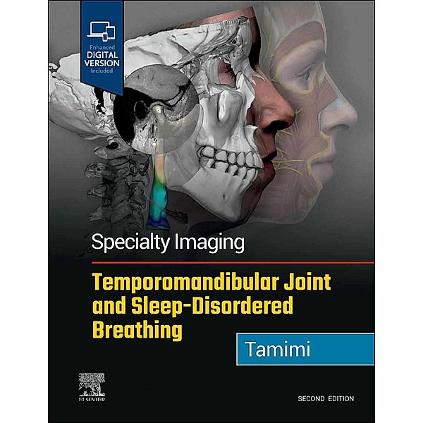 Specialty Imaging: Temporomandibular Joint and Sleep-Disordered Breathing, Dania Tamimi