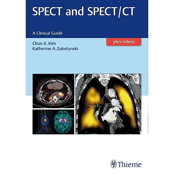 SPECT and SPECT/CT, Chun Kim, Katherine Zukotynski