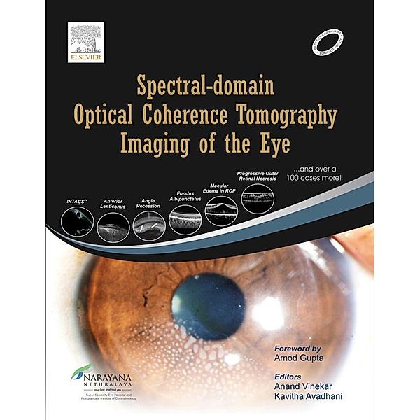 Spectral-domain Optical Coherence Tomography Imaging of the Eye, Anand Vinekar