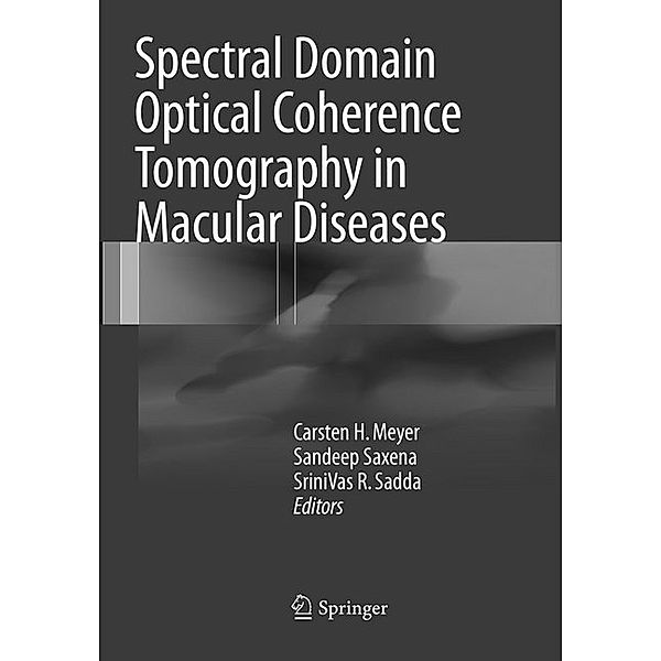 Spectral Domain Optical Coherence Tomography in Macular Diseases