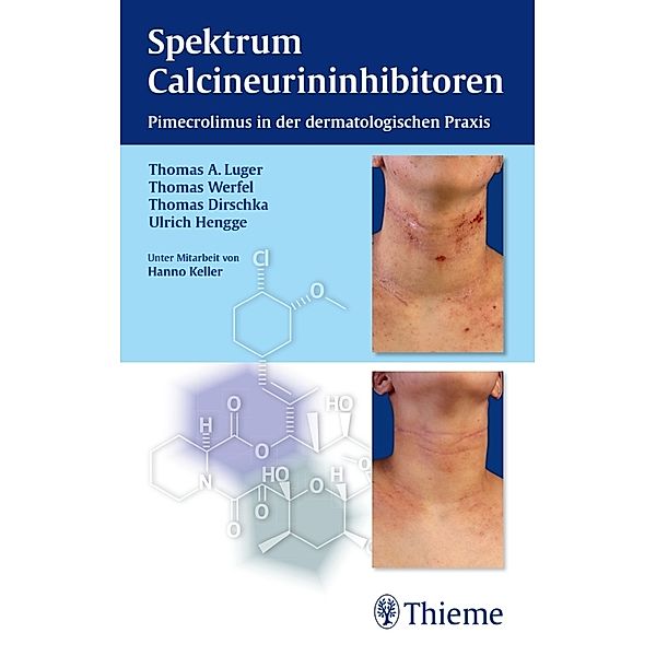 Spektrum Calcineurininhibitoren, Thomas A. Luger, Thomas Dirschka, Ulrich R. Hengge, Hanno Keller