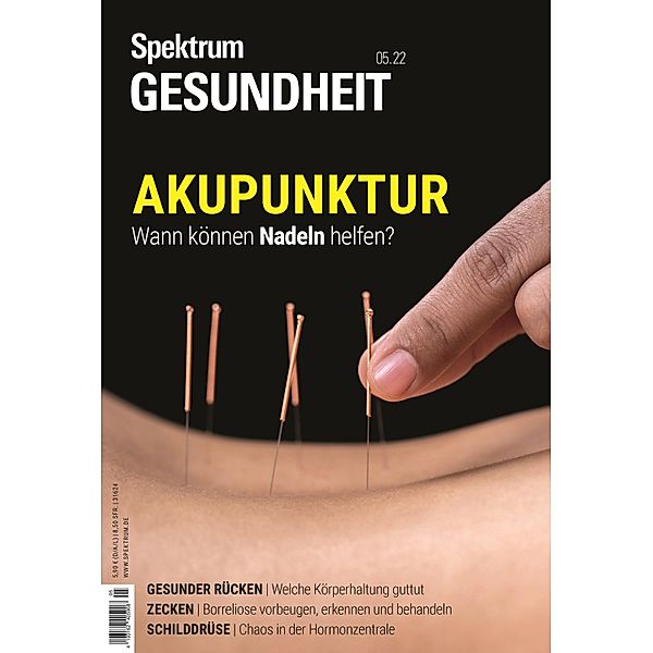 Spektrum Gesundheit- Akupunktur / Spektrum Gesundheit, Spektrum der Wissenschaft