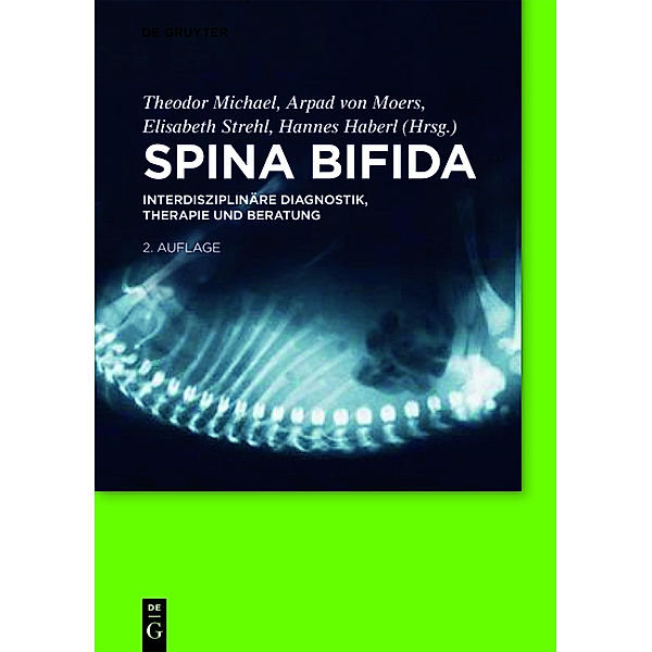 Spina bifida