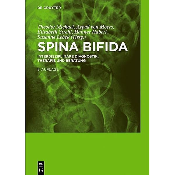 Spina bifida