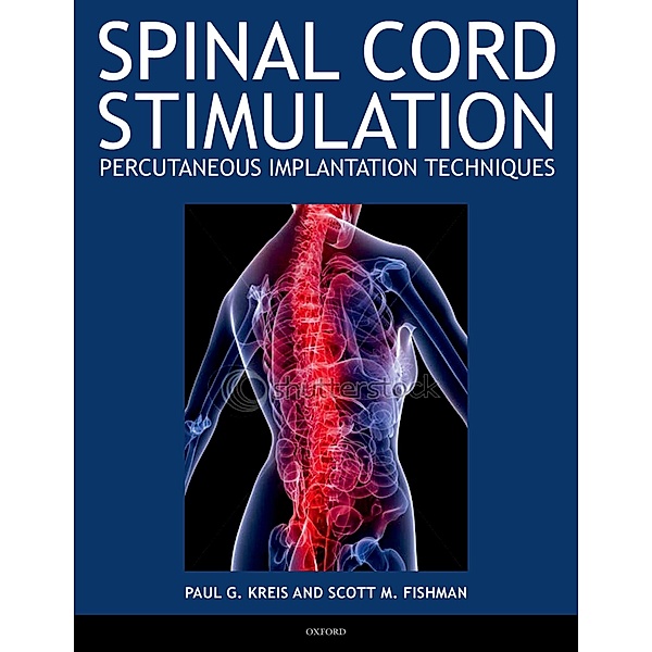 Spinal Cord Stimulation, Paul Kreis, Scott Fishman