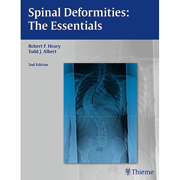 Spinal Deformities, Robert F. Heary, Todd J. Albert
