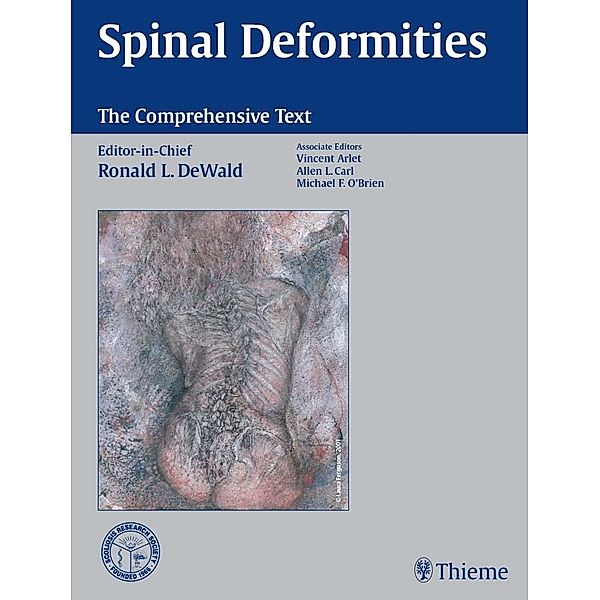 Spinal Deformities: The Comprehensive Text, Ronald L. DeWald