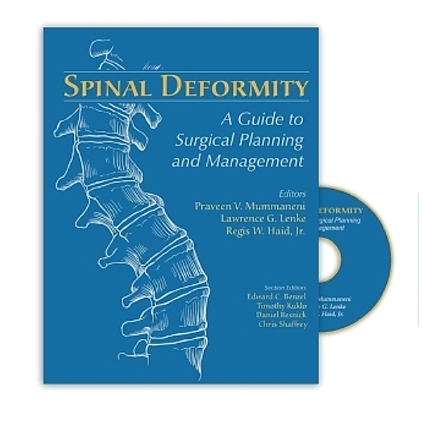 Spinal Deformity, w. DVD