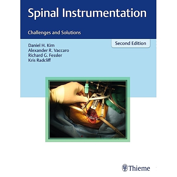 Spinal Instrumentation