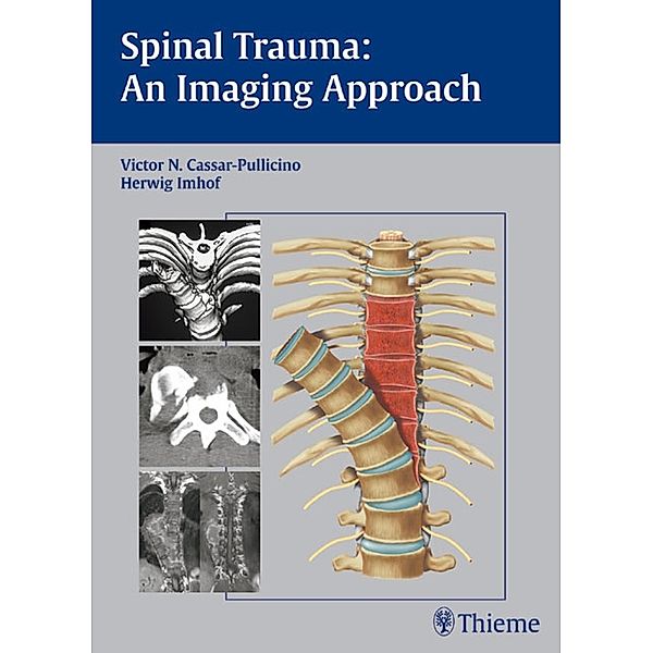 Spinal Trauma - An Imaging Approach, Victor N. Cassar-Pullicino, Herwig Imhof