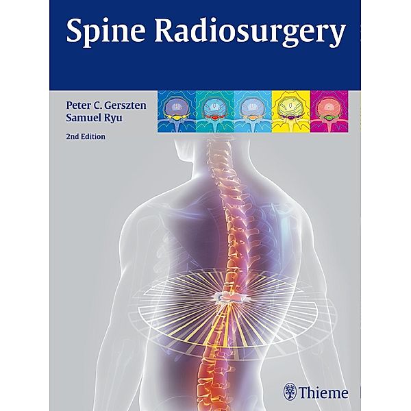 Spine Radiosurgery, Peter C. Gerszten, Ryu. Samuel