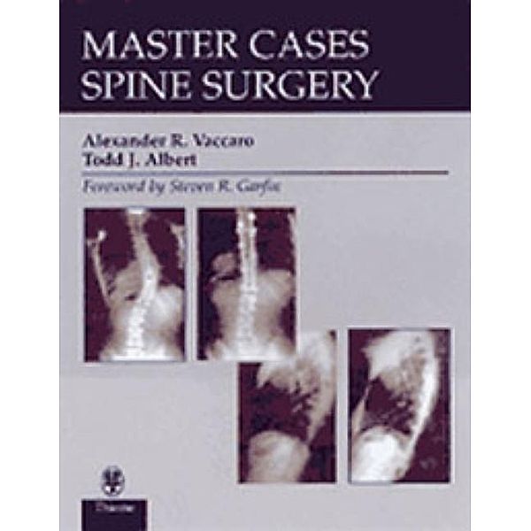 Spine Surgery, Alexander R. Vaccaro, Todd J. Albert