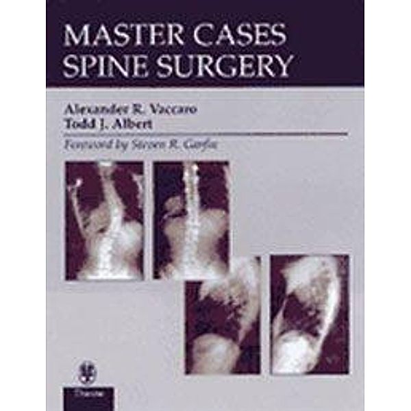 Spine Surgery, Alexander R. Vaccaro, Todd J. Albert