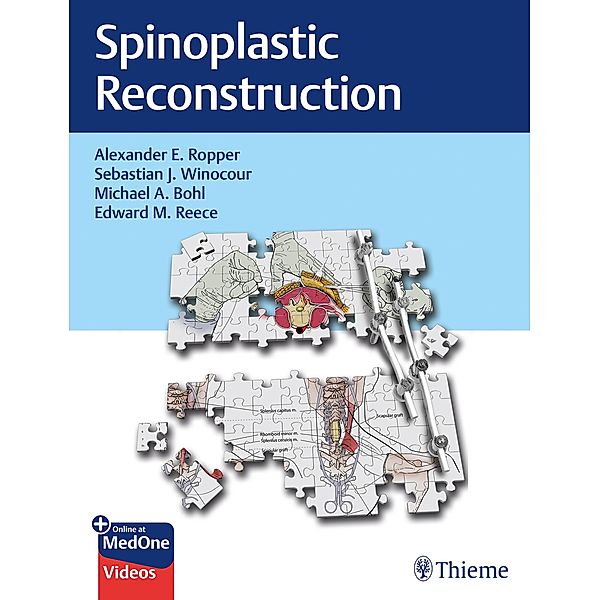 Spinoplastic Reconstruction, Alexander Ropper, Sebastian Winocour, Michael Bohl, Edward Reece