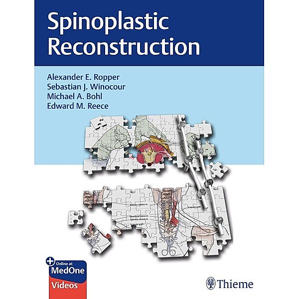 Spinoplastic Reconstruction, Alexander Ropper, Sebastian Winocour, Michael Bohl, Edward Reece