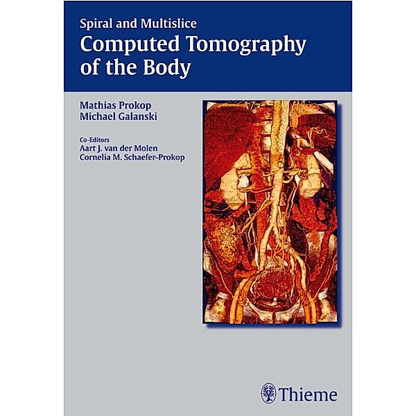 Spiral and Multislice Computed Tomography of the Body