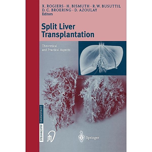 Split liver transplantation
