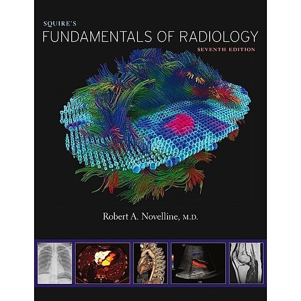 Squire's Fundamentals of Radiology, Robert A. Novelline