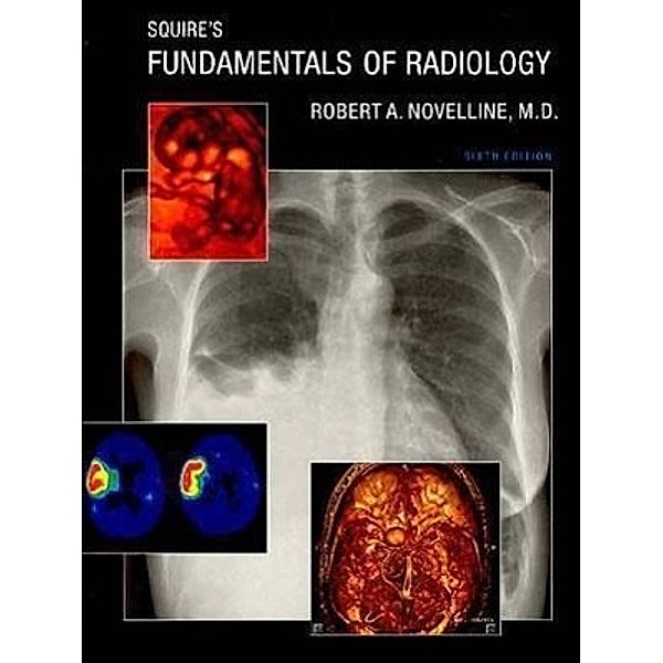 Squire's Fundamentals of Radiology - Sixth Edition, Robert A. Novelline