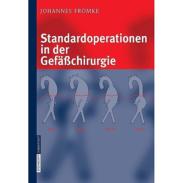 Standardoperationen in der Gefäßchirurgie, Johannes Frömke