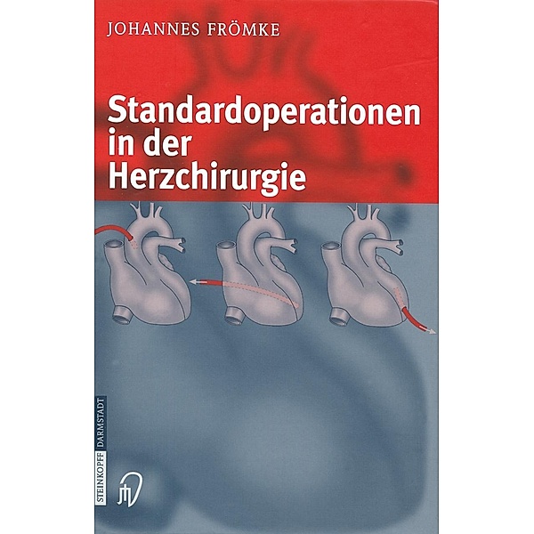 Standardoperationen in der Herzchirurgie, Johannes Frömke