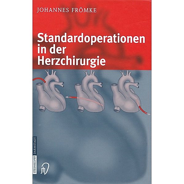 Standardoperationen in der Herzchirurgie, Johannes Frömke