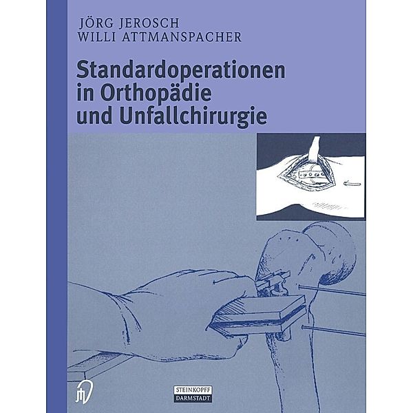 Standardoperationen in Orthopädie und Unfallchirurgie, J. Jerosch, W. Attmanspacher