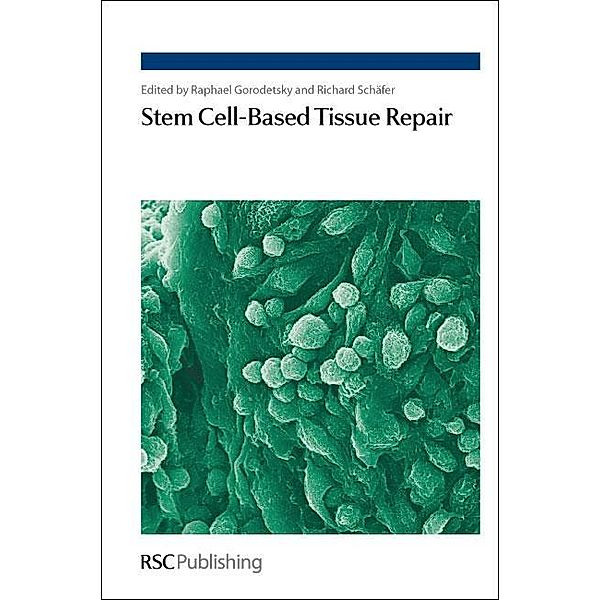 Stem Cell-Based Tissue Repair