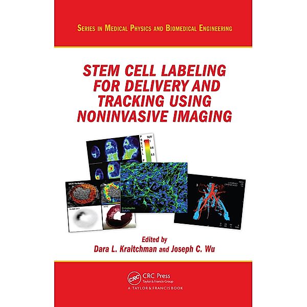 Stem Cell Labeling for Delivery and Tracking Using Noninvasive Imaging